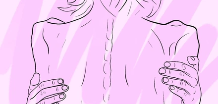 История болезни: про&nbsp;анорексию из&nbsp;первых уст